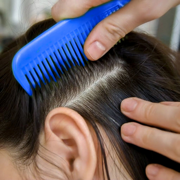Профілактика педикульозу